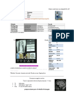 1 Preparación Del PX + Contraste