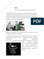 Angiografia Cerebral