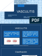 Vasculitis