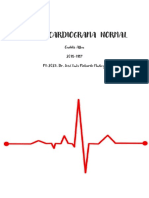 Electrocardiograma Normal