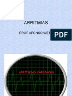 Arritmias: Prof Afonso Wete