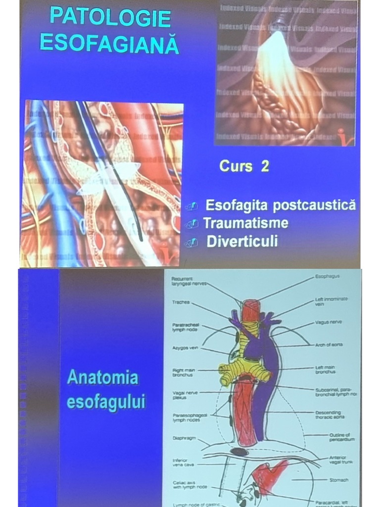 Esofag 2 | PDF