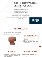 Escoliosis Lumbar