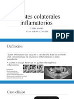 Quistes colaterales inflamatorios: definición, síntomas y tratamiento