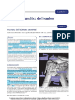 Fractura Miembro Sup PDF