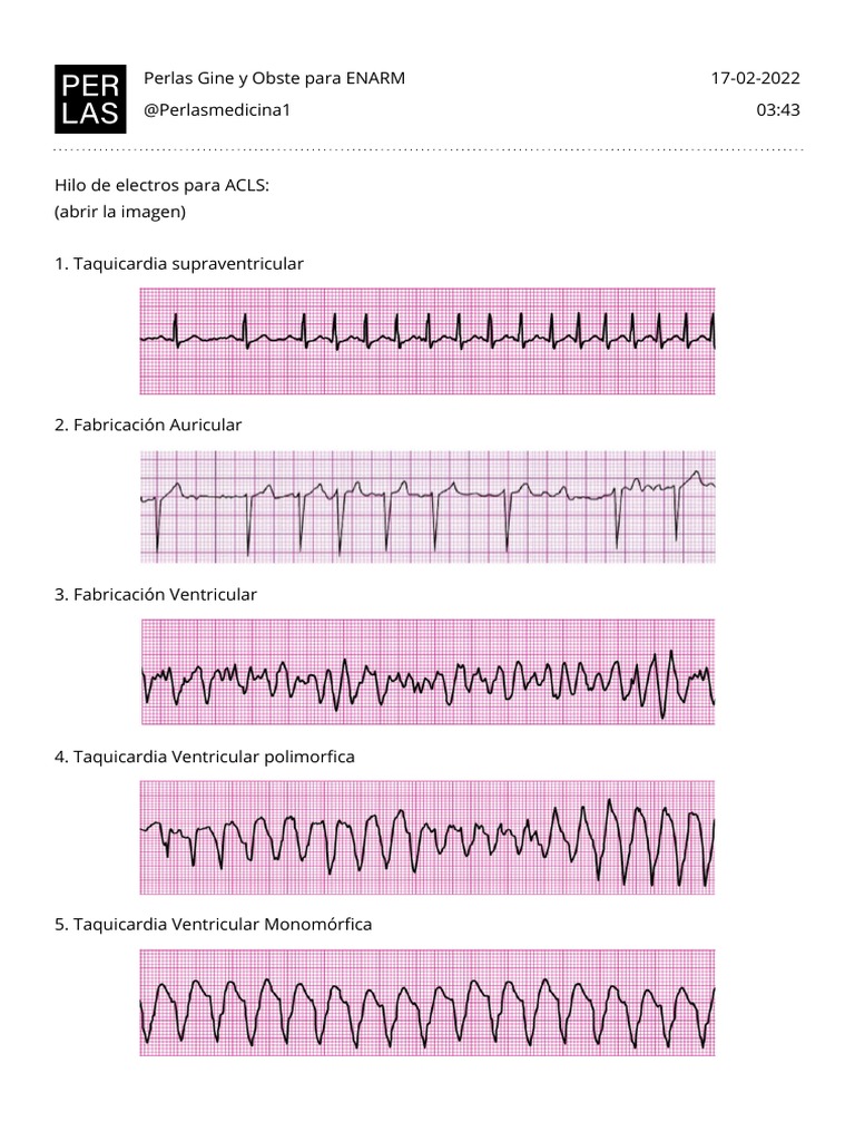 Ritmos ECG para ACLS: Guía Esencial | PDF