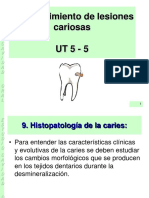 UT 5 - 5 Reconocimiento de Lesiones Cariosas PDF