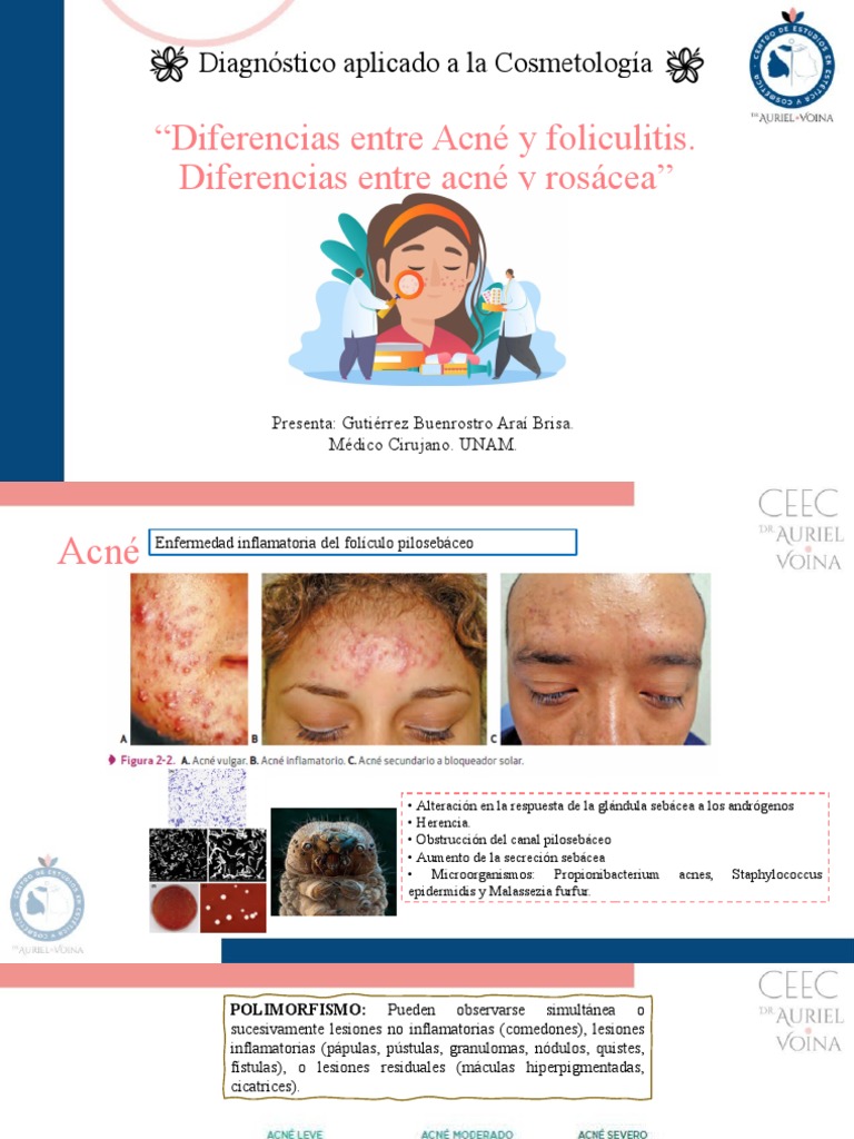 Acné vs foliculitis vs rosácea (1) PDF Inflamación Condiciones