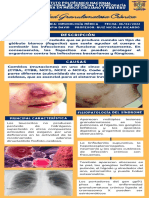Enfermedad Granulomatosa Crónica - Martinez Tapia David PDF