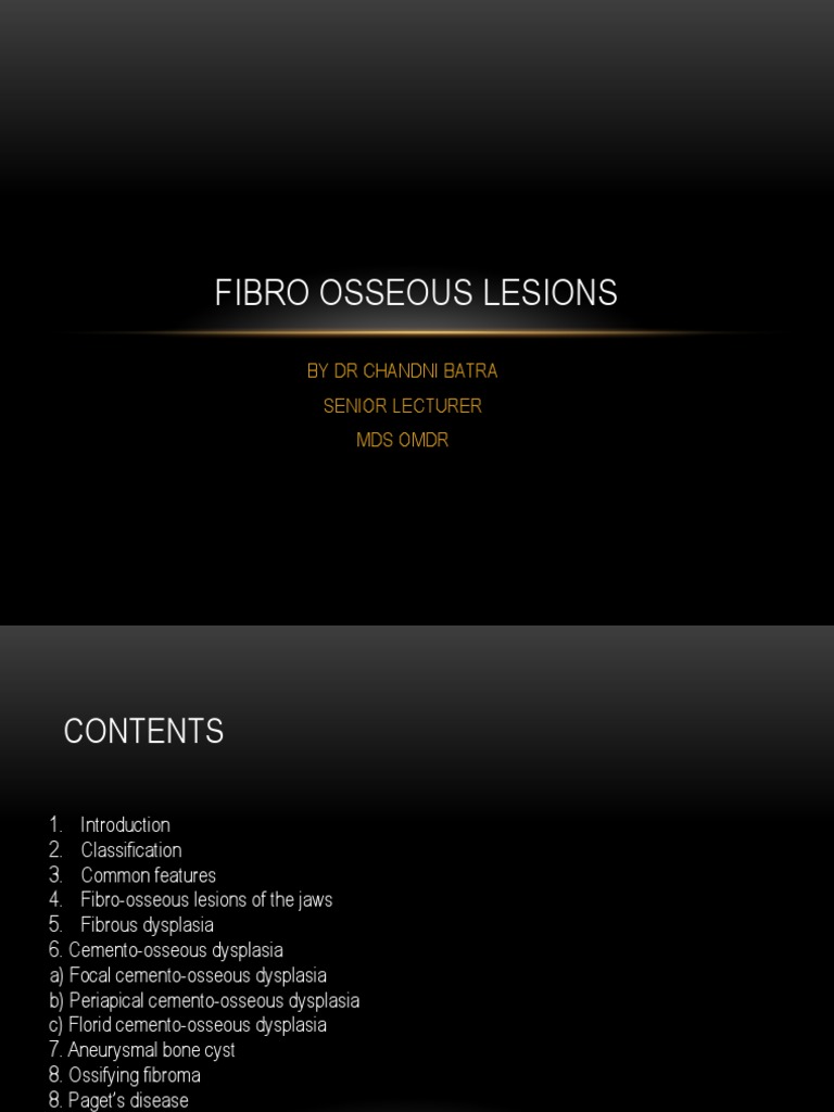 FibroOsseous Lesions of the Jaws Explained PDF Bone Medical