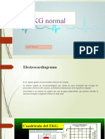 EKG Normal Presentacion