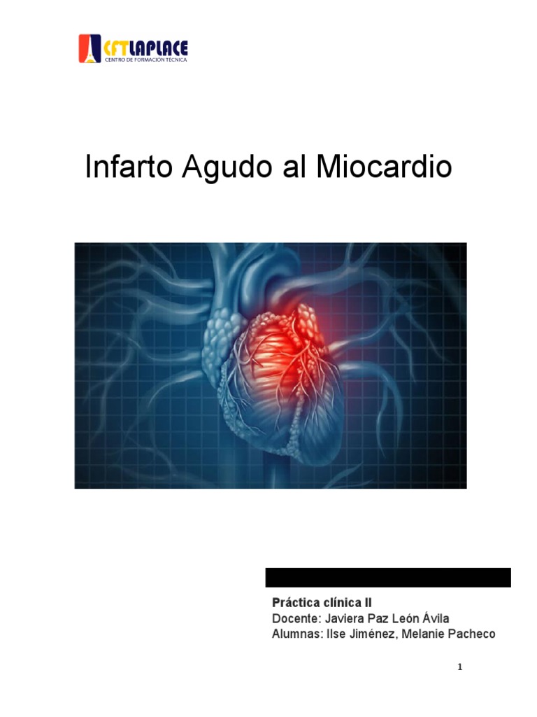 Infarto Agudo Al Miocardio: Práctica Clínica II | PDF | Infarto de ...