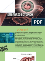 Embarazo Ectópico