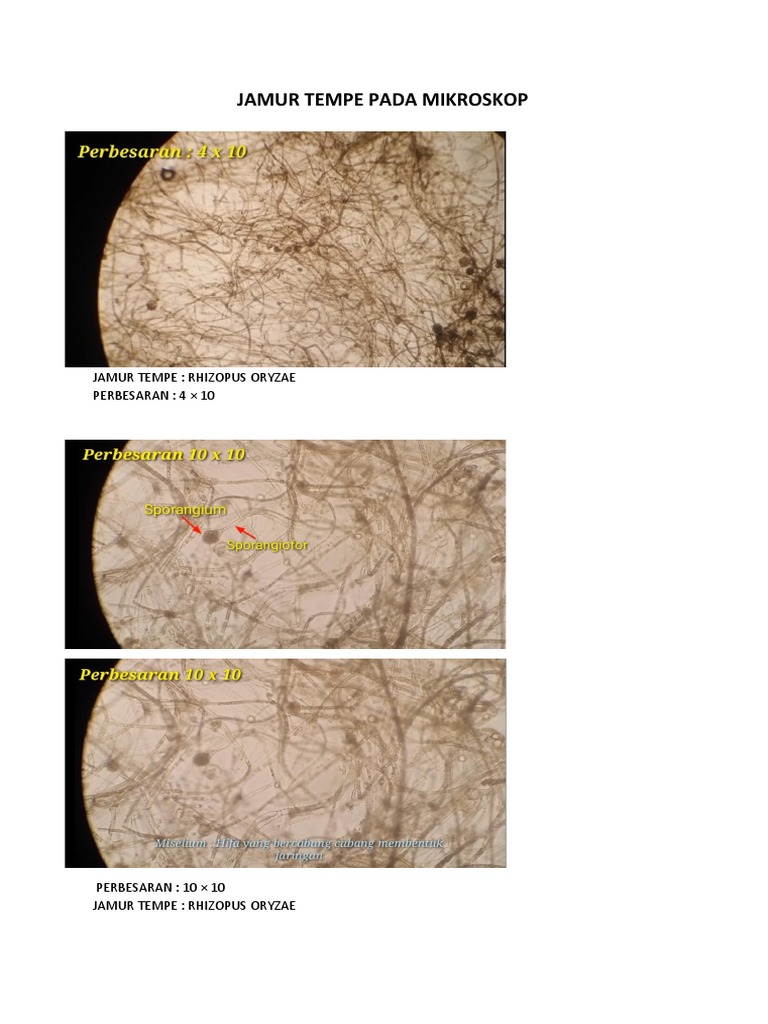 Jamur Tempe Pada Mikroskop | PDF
