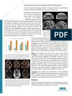Clinical evaluation of AI-powered registration software SmartFuse for radiotherapy workflows