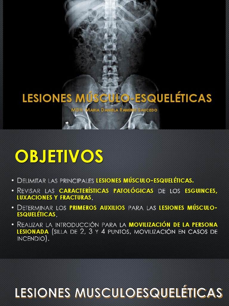 Lesiones Músculo-Esqueléticas: Tipos y Primeros Auxilios | PDF | Hueso ...