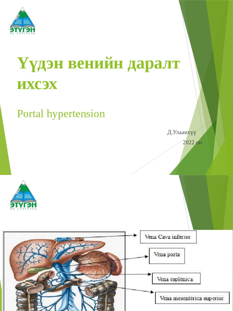 2.Үүдэн венийн даралт ихсэлт2022 PDF | PDF