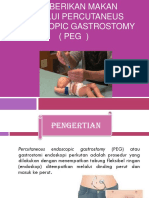 Memberikan Makan Melalui Percutaneus Endoscopic Gastrostomy (Peg)