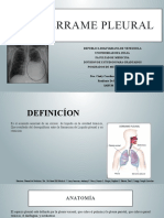 Derrame Pleural