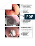 Otorrinolaringología: Diagnósticos y hallazgos clínicos