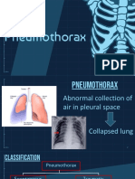 Pneumothorax