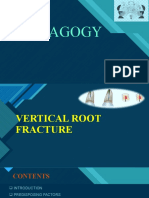 Vertical Root Fracture