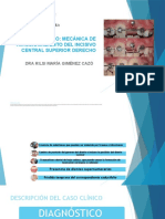 Caso Clínico: Mecánica de Traccionamiento Del Incisivo Central Superior Derecho