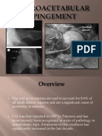 Femoroacetabular Impingement