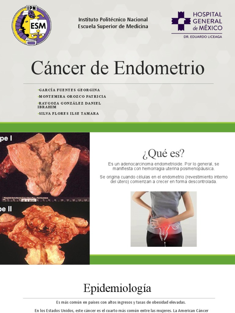 Cancer Endometrio | PDF | Mamíferos Hembras | Cuidado de la salud