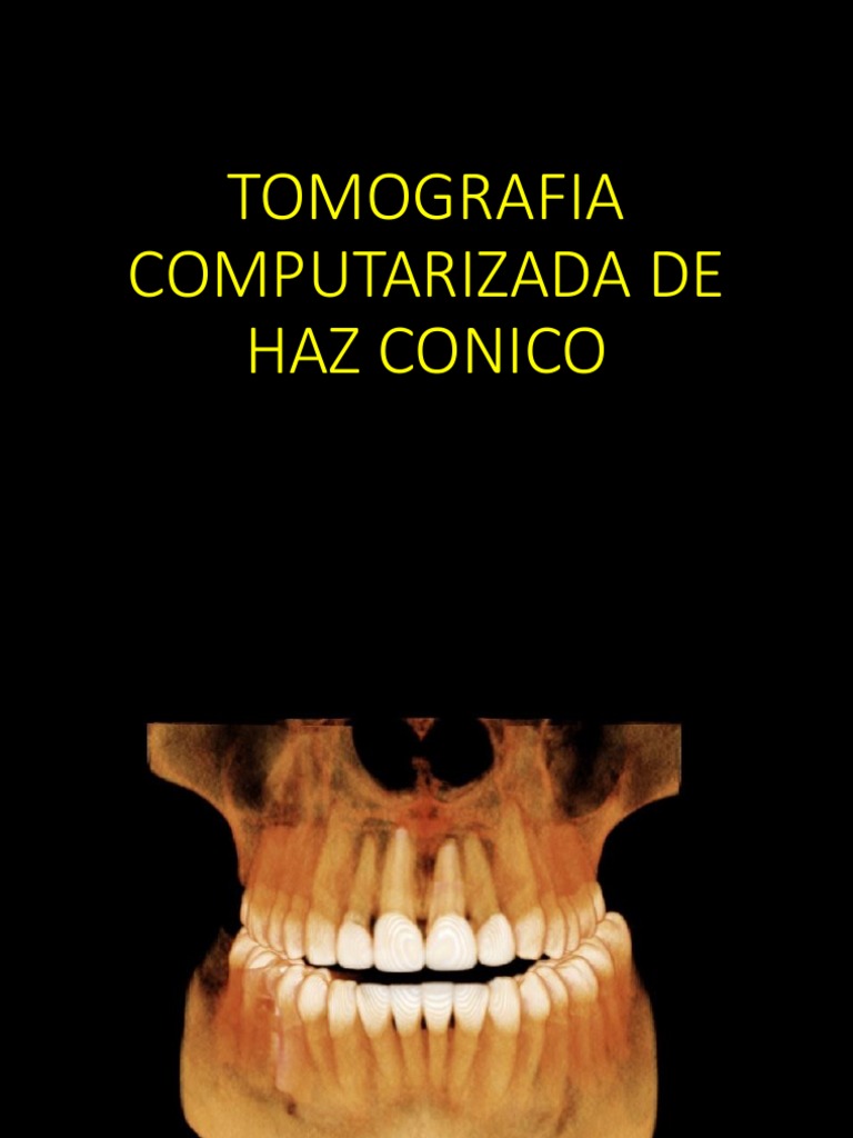 Tomografía Cone Beam en Odontología | PDF | Ct Scan | Imagenes medicas
