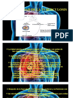 Inmunidad de La Tuberculosis