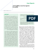 Correction of Vertical Maxillary Excess by Superior Repositioning of The Maxilla