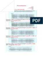 Electrocardiogramas 