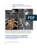 Fracturas vertebrales por compresión: causas, síntomas y tratamiento