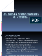 LES TUMEURS DE L - UTERUS - ppt1