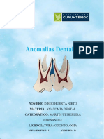 Anomalias dentales de diego