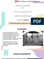 Periodontitis Apical Crónica