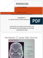 Radiologi CT Scan Brain Baim Fix