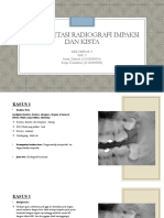 Interpretasi Radiografi Impaksi Dan Kista: Kelompok 4 SGD 5 Intan Zahroh (31102000039) Surya Dimastiar (31102000083)
