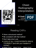 Chest X Ray Made Simple
