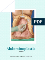 ABDOMINOPLASTIAS. Annarella.