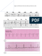 Electrocardiograma