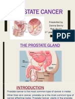 Prostate Cancer: Presented By, Denna Benny Roll. No:21 3 Year B. SC Nursing