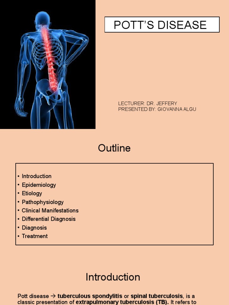 Pott Disease PDF Tuberculosis Vertebral Column