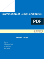 The consistency of a lump can provide clues to its nature and should be described objectively using terms such as hard, firm, soft, cystic or fluid-filled