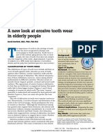 A New Look at Erosive Tooth Wear