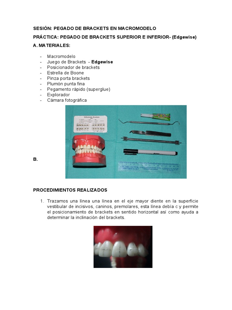 Pegado de Brackets Edgewise en Macromodelo | PDF