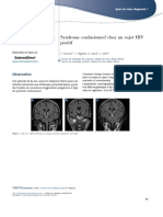 Syndrome Confusionnel Chez Un Sujet Hiv Positif: Sciencedirect