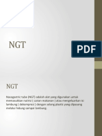 NGT Pemasangan dan Manfaatnya