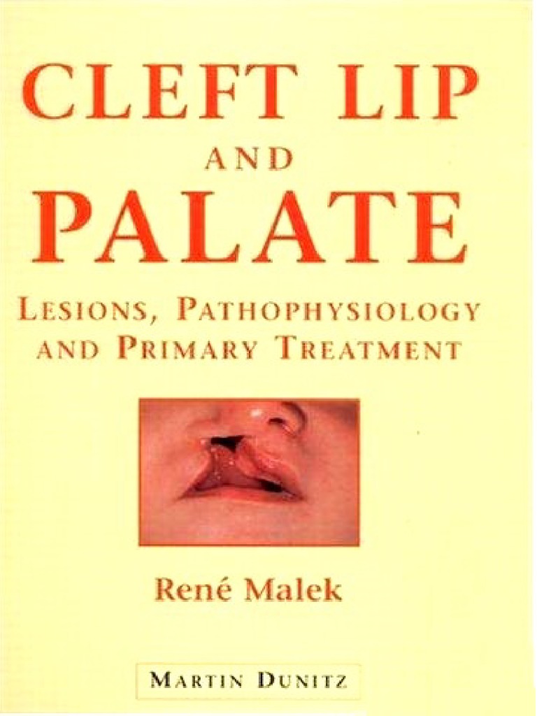 Cleft Lip and Palate - René Malek | PDF | Human Nose | Surgery